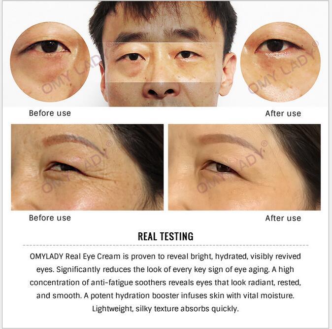 Eye cream, eye wrinkle cream - watkins innovators