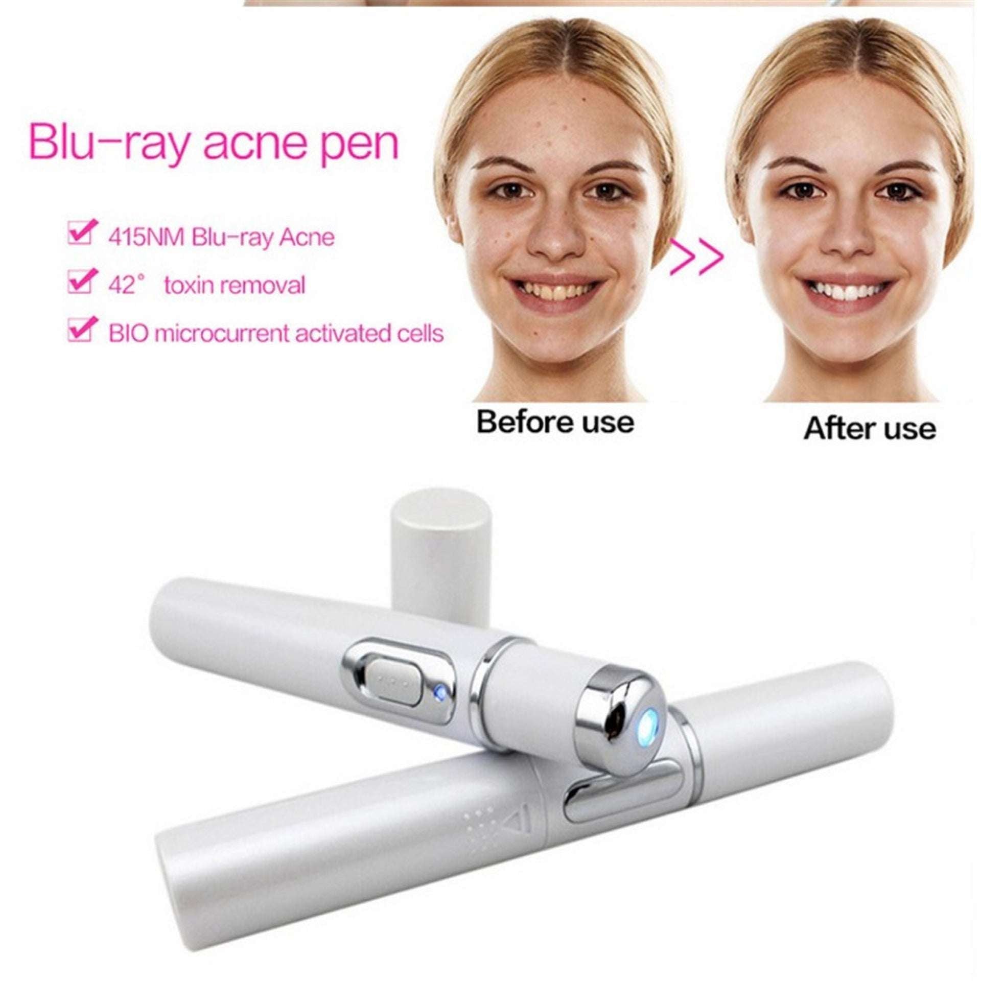 Blue Light Therapy Acne Laser Pen Soft Scar Wrinkle Removal Treatment Device Skin Care Beauty Equipment - watkins innovators
