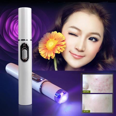 Blue Light Therapy Acne Laser Pen Soft Scar Wrinkle Removal Treatment Device Skin Care Beauty Equipment - watkins innovators
