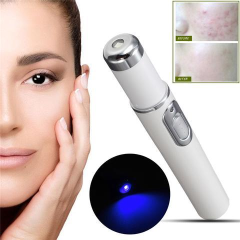 Blue Light Therapy Acne Laser Pen Soft Scar Wrinkle Removal Treatment Device Skin Care Beauty Equipment - watkins innovators