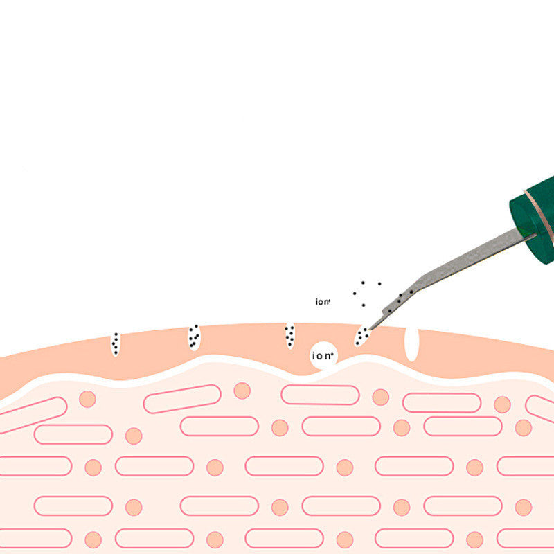 Ultrasonic Skin Rejuvenation Whitening Shoveling Machine Exfoliating Skin Care - watkins innovators